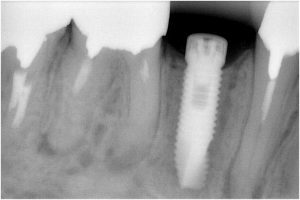 %e7%9f%b3%e5%b7%9d8-%e5%9f%8b%e5%85%a5x%e7%b7%9a%e3%80%80